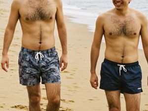毛深い男性は印象が悪い？女性が感じる本音と対策まとめ